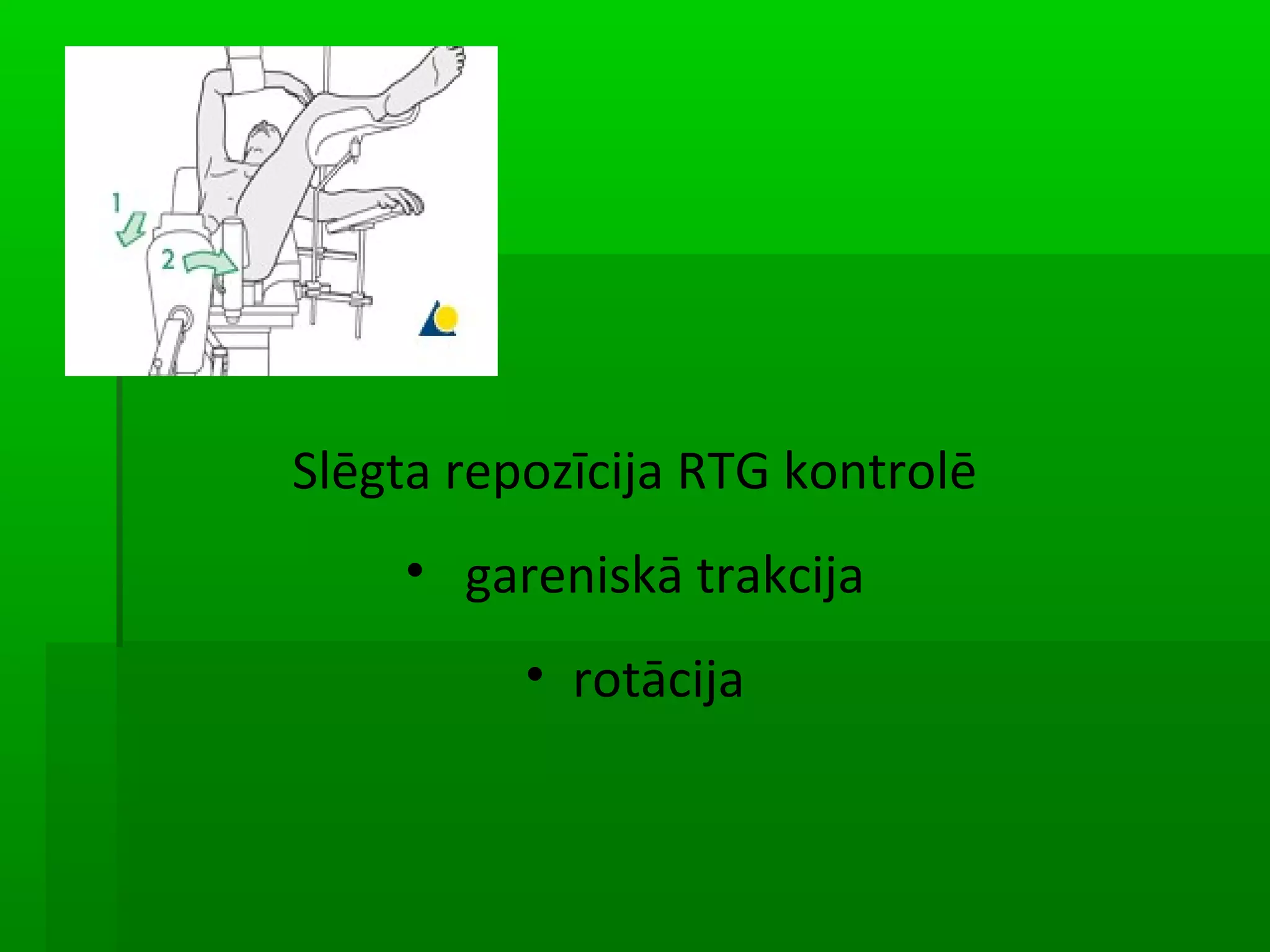Slēgta repozīcija RTG kontrolē
    • gareniskā trakcija
          • rotācija
 