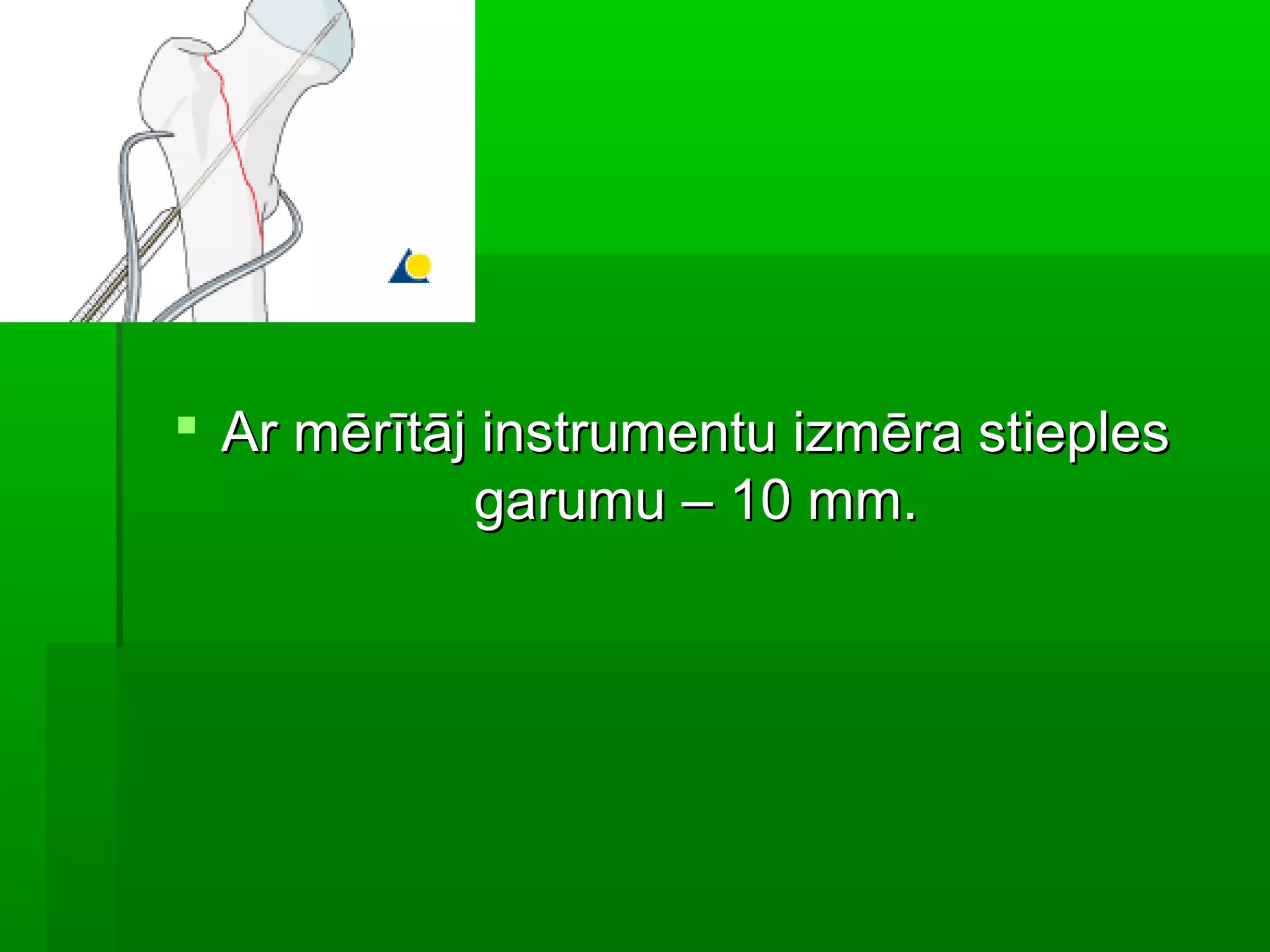  Ar mērītāj instrumentu izmēra stieples
             garumu – 10 mm.
 