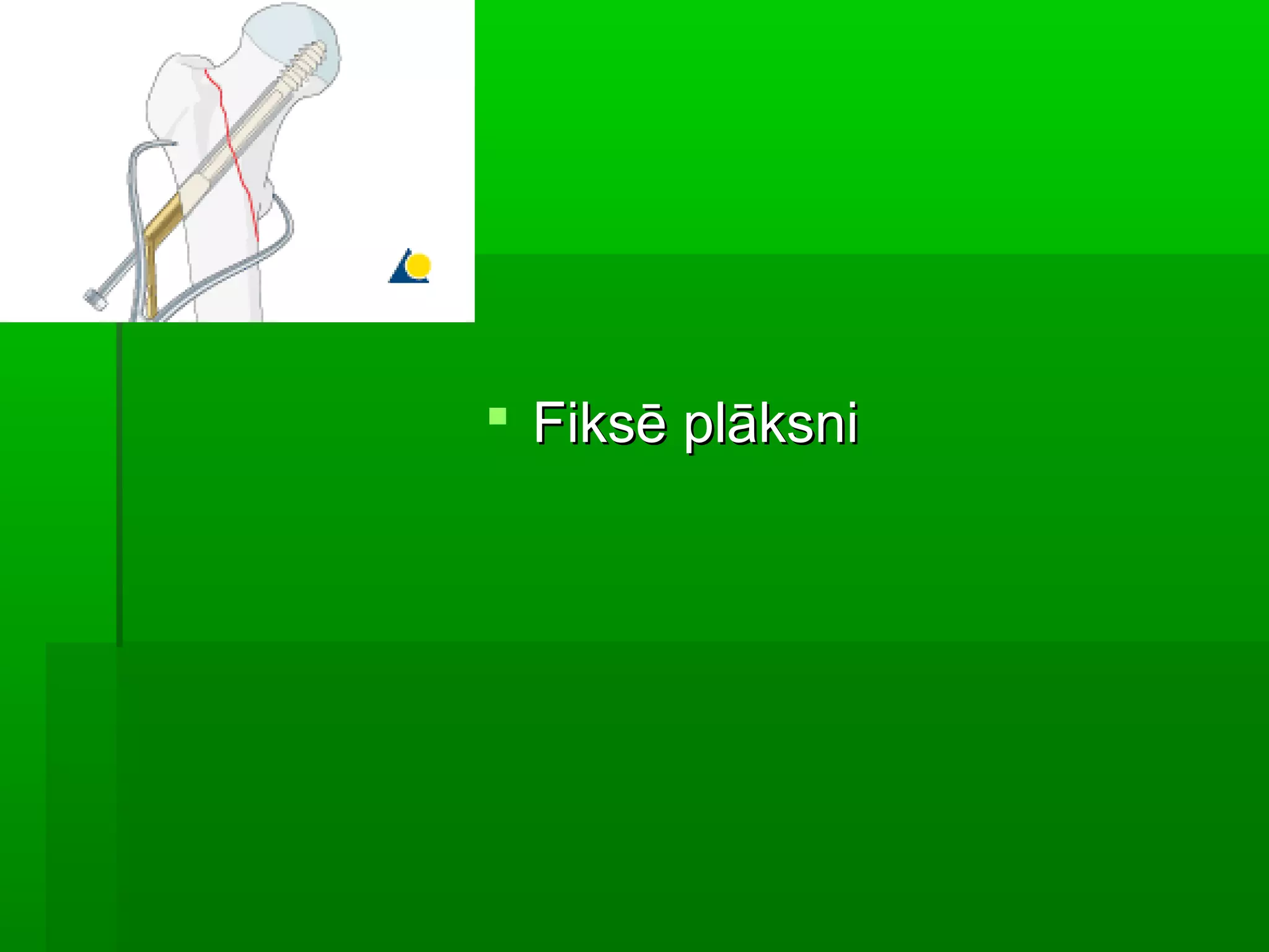  Fiksē plāksni
 