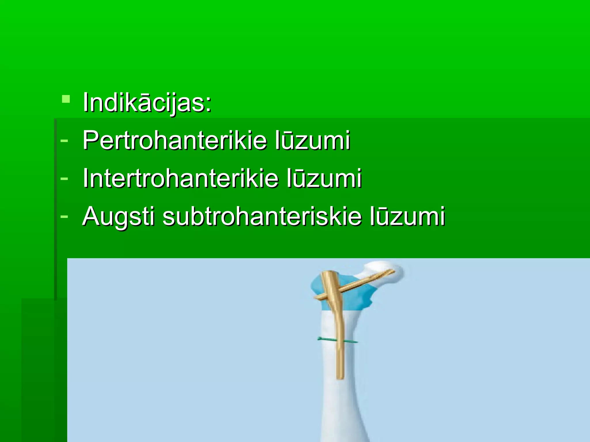    Indikācijas:
-   Pertrohanterikie lūzumi
-   Intertrohanterikie lūzumi
-   Augsti subtrohanteriskie lūzumi
 