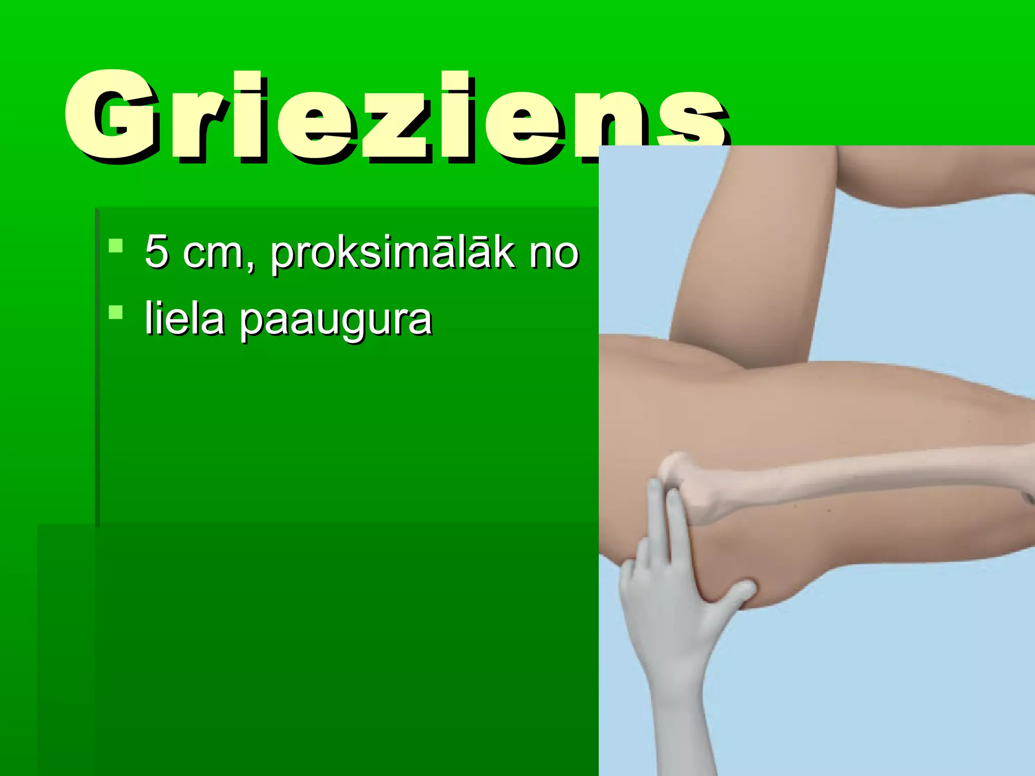 Grieziens
 5 cm, proksimālāk no
 liela paaugura
 