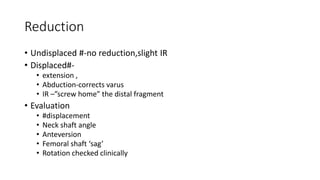 Reduction
• Undisplaced #-no reduction,slight IR
• Displaced#-
• extension ,
• Abduction-corrects varus
• IR –”screw home” the distal fragment
• Evaluation
• #displacement
• Neck shaft angle
• Anteversion
• Femoral shaft ‘sag’
• Rotation checked clinically
 