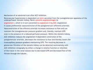 Mechanism of an abnormal scan after ACE inhibition.
Renovascular hypertension is dependent on renin secretion from the juxtaglomerular apparatus of the
underperfused, stenotic kidney. Renin converts angiotensinogen to
angiotensin I, which is in turn converted to angiotensin II by ACE. Angiotensin
II causes preferential vasoconstriction of the postglomerular (efferent) arteriole.
Vasoconstriction of the efferent arteriole increases resistance to flow and can
maintain the transglomerular pressure gradient and, thereby, maintain GFR
even in the presence of a reduced perfusion pressure. Within the stenotic kidney,
ACE inhibition reduces the angiotensin II dependent constriction of the
postglomerular arteriole, decreases the resistance to flow and thereby lowers the
transcapillary pressure gradient maintaining GFR. The resulting decrease in
glomerular filtration of the stenotic kidney can be detected noninvasively with
ACE-inhibition renography by either a change in relative function or retention
of the tracer in the renal tubules due to decreased GFR and decreased flow of the
filtrate through the tubules .
 