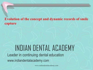 Evolution of the concept and dynamic records of smile
capture

INDIAN DENTAL ACADEMY
Leader in continuing dental education
www.indiandentalacademy.com
www.indiandentalacademy.com

 