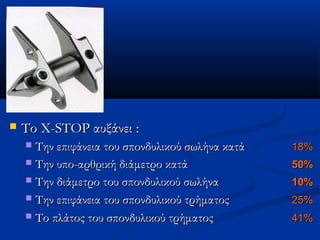  ΤΤοο XX--SSTTOOPP ααυυξξάάννεειι :: 
 ΤΤηηνν εεππιιφφάάννεειιαα ττοουυ σσπποοννδδυυλλιικκοούύ σσωωλλήήνναα κκααττάά 1188%% 
 ΤΤηηνν υυπποο--ααρρθθρριικκήή δδιιάάμμεεττρροο κκααττάά 5500%% 
 ΤΤηηνν δδιιάάμμεεττρροο ττοουυ σσπποοννδδυυλλιικκοούύ σσωωλλήήνναα 1100%% 
 ΤΤηηνν εεππιιφφάάννεειιαα ττοουυ σσπποοννδδυυλλιικκοούύ ττρρήήμμααττοοςς 2255%% 
 ΤΤοο ππλλάάττοοςς ττοουυ σσπποοννδδυυλλιικκοούύ ττρρήήμμααττοοςς 4411%% 
 