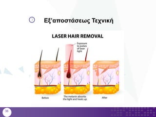 36
Εξ’αποστάσεως Τεχνική
 