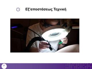 37
Εξ’αποστάσεως Τεχνική
 