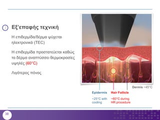 Epidermis
~25°C with
cooling
Dermis ~45°C
Hair Follicle
~60°C during
HR procedure
Εξ’επαφής τεχνική
Η επιδερμίδα/δέρμα ψύχεται
ηλεκτρονικά (TEC)
Η επιδερμίδα προστατεύεται καθώς
το δέρμα αναπτύσσει θερμοκρασίες
υψηλές (60°C)
Λιγότερος πόνος
38
 