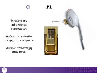I.P.L
Μειώνει την
πιθανότητα
εγκαύματος
Αυξάνει το επίπεδο
ανοχής στην ενέργεια
Αυξάνει την αντοχή
στον πόνο
39
 