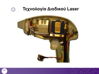 Τεχνολογία Διοδικού Laser
40
 