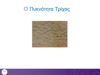 Πυκνότητα Τρίχας
43
 