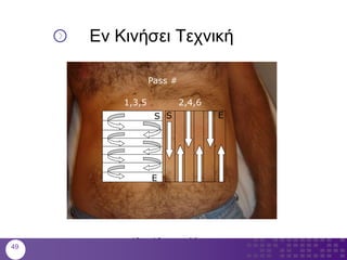 Εν Κινήσει Τεχνική
S
E
ES
1,3,5 2,4,6
10 x 10 cm grid
Pass #
49
 