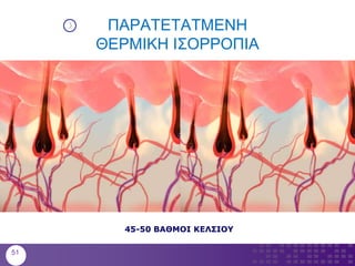 ΠΑΡΑΤΕΤΑΤΜΕΝΗ
ΘΕΡΜΙΚΗ ΙΣΟΡΡΟΠΙΑ
45-50 ΒΑΘΜΟΙ ΚΕΛΣΙΟΥ
51
 