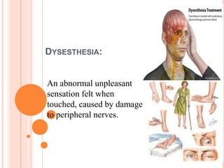 DYSESTHESIA:
An abnormal unpleasant
sensation felt when
touched, caused by damage
to peripheral nerves.
 