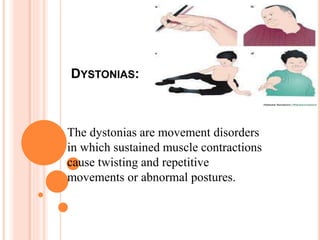 DYSTONIAS:
The dystonias are movement disorders
in which sustained muscle contractions
cause twisting and repetitive
movements or abnormal postures.
 