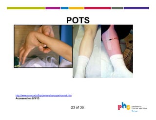 POTS

http://www.nymc.edu/fhp/centers/syncope/normal.htm

Accessed on 8/5/13

23 of 36

 