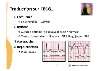 CHU_Hôpitaux de Rouen - page 10
TraducTon	
  sur	
  l’ECG…	
  
!  Fréquence	
  
!  En	
  général	
  60	
  –	
  100/min	
  
!  Rythme	
  
!  Auriculo-­‐entrainé	
  :	
  spikes	
  avant	
  onde	
  P	
  normale	
  
! Ventriculo-­‐entrainé	
  :	
  spikes	
  avant	
  QRS	
  élargi	
  (aspect	
  BBG)	
  
!  Axe	
  gauche	
  
!  RepolarisaTon	
  
!  Discordance	
  
 
