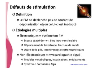 • CHU_Hôpitaux de Rouen - page 22
Défauts	
  de	
  sTmulaTon	
  
!  DéﬁniTon	
  
!  Le	
  PM	
  ne	
  déclenche	
  pas	
  de	
  courant	
  de	
  
dépolarisa%on	
  et/ou	
  celui-­‐ci	
  est	
  inadapté	
  
!  ÉTologies	
  mulTples	
  
!  Électroniques	
  =	
  dysfonc%on	
  PM	
  	
  
!  Écoute	
  exagérée	
  +++,	
  bloc	
  intra-­‐ventriculaire	
  
!  Déplacement	
  de	
  l'électrode,	
  fracture	
  de	
  sonde	
  
!  Usure	
  de	
  la	
  pile,	
  interférences	
  électromagné%ques	
  
!  Non-­‐électroniques	
  =	
  myocardiopathie	
  aiguë	
  
!  Troubles	
  métaboliques,	
  intoxica%ons,	
  médicaments	
  
!  Syndrome	
  Coronarien	
  Aigu	
  	
  
 