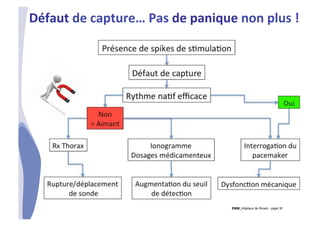 CHU_Hôpitaux de Rouen - page 30
Défaut	
  de	
  capture…	
  Pas	
  de	
  panique	
  non	
  plus	
  !	
  
 