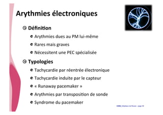 • CHU_Hôpitaux de Rouen - page 39
Arythmies	
  électroniques	
  
!  DéﬁniTon	
  
!  Arythmies	
  dues	
  au	
  PM	
  lui-­‐même	
  
!  Rares	
  mais	
  graves	
  
!  Nécessitent	
  une	
  PEC	
  spécialisée	
  
!  Typologies	
  
!  Tachycardie	
  par	
  réentrée	
  électronique	
  
!  Tachycardie	
  induite	
  par	
  le	
  capteur	
  
!  «	
  Runaway	
  pacemaker	
  »	
  
!  Arythmies	
  par	
  transposi%on	
  de	
  sonde	
  	
  
!  Syndrome	
  du	
  pacemaker	
  	
  
 