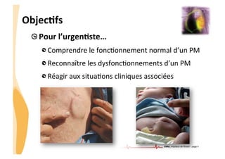 CHU_Hôpitaux de Rouen - page 4
ObjecTfs	
  
!  Pour	
  l’urgenTste…	
  
!  Comprendre	
  le	
  fonc%onnement	
  normal	
  d’un	
  PM	
  
!  Reconnaître	
  les	
  dysfonc%onnements	
  d’un	
  PM	
  
!  Réagir	
  aux	
  situa%ons	
  cliniques	
  associées	
  	
  	
  
 