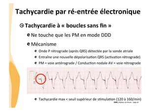 CHU_Hôpitaux de Rouen - page 40
Tachycardie	
  par	
  ré-­‐entrée	
  électronique	
  
!  Tachycardie	
  à	
  «	
  boucles	
  sans	
  ﬁn	
  »	
  
!  Ne	
  touche	
  que	
  les	
  PM	
  en	
  mode	
  DDD	
  
!  Mécanisme	
  
!   Onde	
  P	
  rétrograde	
  (après	
  QRS)	
  détectée	
  par	
  la	
  sonde	
  atriale	
  
!   Entraîne	
  une	
  nouvelle	
  dépolarisa%on	
  QRS	
  (ac%va%on	
  rétrograde)	
  
!   PM	
  =	
  voie	
  antérograde	
  /	
  Conduc%on	
  nodale	
  AV	
  =	
  voie	
  rétrograde	
  
	
  
	
  
!   Tachycardie	
  max	
  <	
  seuil	
  supérieur	
  de	
  s%mula%on	
  (120	
  à	
  160/min)	
  
 