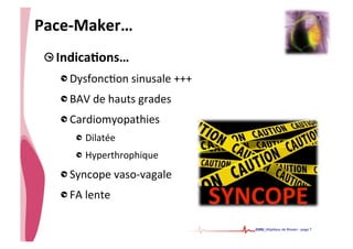 • CHU_Hôpitaux de Rouen - page 7
Pace-­‐Maker…	
  
!  IndicaTons…	
  
!  Dysfonc%on	
  sinusale	
  +++	
  
!  BAV	
  de	
  hauts	
  grades	
  
!  Cardiomyopathies	
  
!  Dilatée	
  
! Hyperthrophique	
  
!  Syncope	
  vaso-­‐vagale	
  
!  FA	
  lente	
  
 