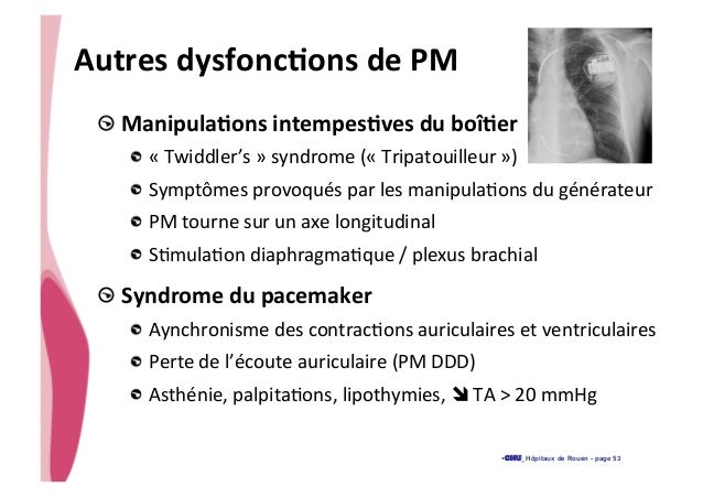 Dysfonction d'un pm urgences 2014 slideshare - 웹