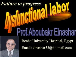 Failure to progress
Benha University Hospital, Egypt
Email: elnashar53@hotmail.com
 