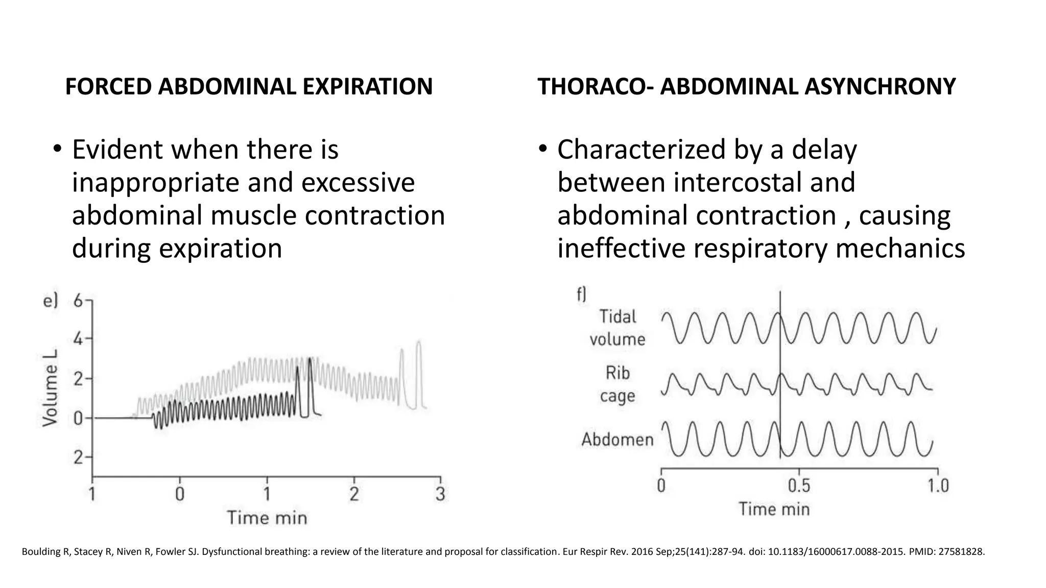 Dysfunctional breathing | PPTX