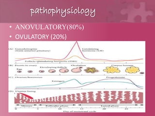 pathophysiology
• ANOVULATORY(80%)
• OVULATORY (20%)
 