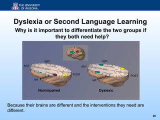 Dyslexia or Second Language Learning
   Why is it important to differentiate the two groups if
                   they both need help?




Because their brains are different and the interventions they need are
different.
                                                                         20
 