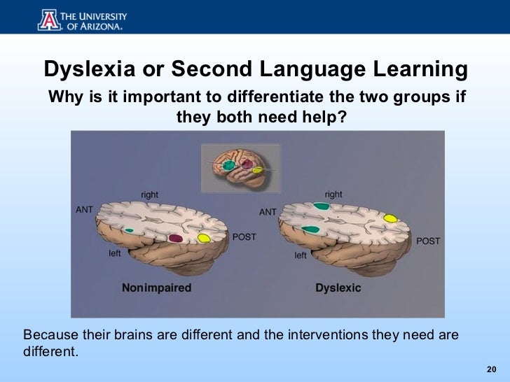 dyslexia and language acquisition essay Dyslexia is a language-based learning disability and writing essays people with dyslexia can also have problems with spoken language, even after they have been exposed to good language models in their homes and good language instruction in school. dyslexia and language acquisition essay Dyslexia is a language-based learning disability and writing essays people with dyslexia can also have problems with spoken language, even after they have been exposed to good language models in their homes and good language instruction in school.