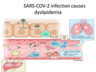 SARS-COV-2 infection causes
dyslipidemia
 