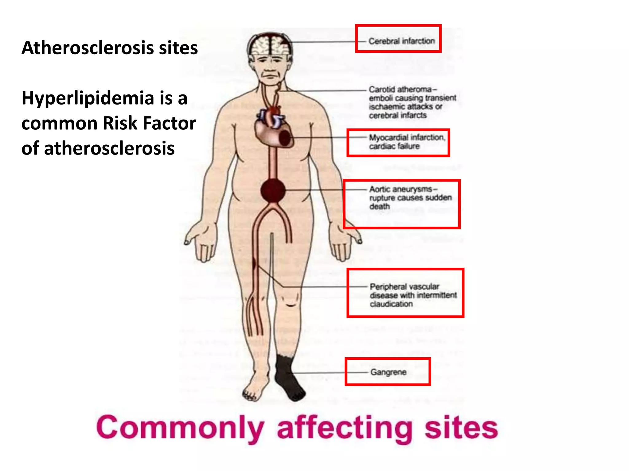 Atherosclerosis sites
Hyperlipidemia is a
common Risk Factor
of atherosclerosis
 