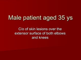 Male patient aged 35 ys
    C/o of skin lesions over the
  extensor surface of both elbows
             and knees
 