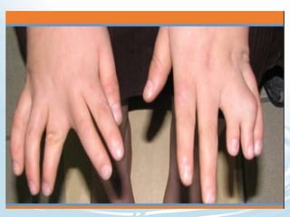 Approach to Dysmorphic Infant or Child | PPTX