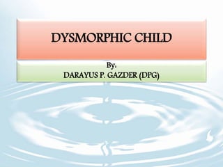DYSMORPHIC CHILD
By:
DARAYUS P. GAZDER (DPG)
 