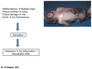 • Malformations  Multiple major
•Tissue involved  many.
•Tissue damage  Yes.
•Joints  2ry Contractures.
Disruption
Sequence  2ry deformation =
Neuropathic AMC
M. Al-Haggar, MD.
 