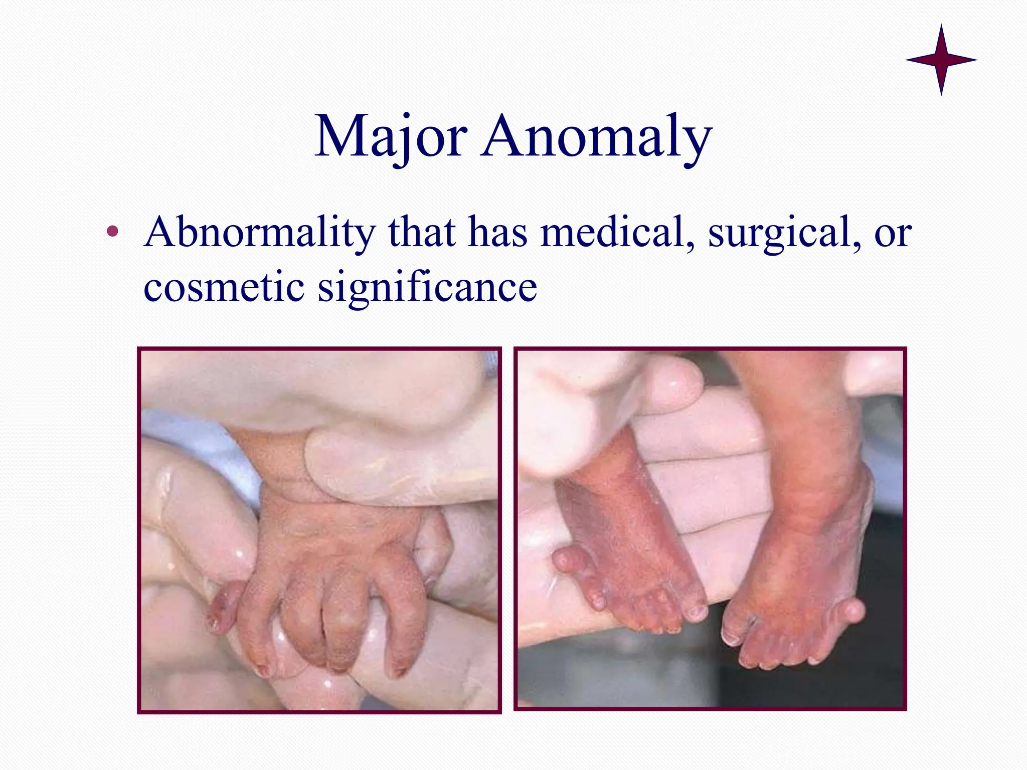 Major Anomaly
• Abnormality that has medical, surgical, or
cosmetic significance
 