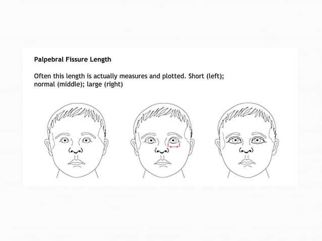 Dysmorphology Student upload Dr.Khaled.ppt