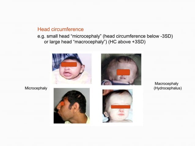 Dysmorphology Student upload Dr.Khaled.ppt