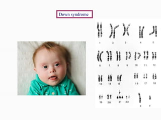 Dysmorphology Student upload Dr.Khaled.ppt