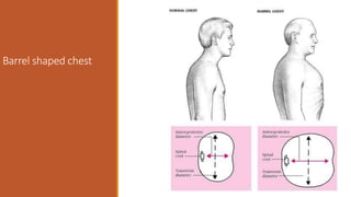 Approach to Dysnea and Wheezing | PPTX