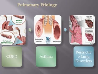 COPD Asthma
Restrictiv
e Lung
Disorders
Pulmonary Etiology
 