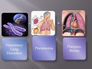 Hereditary
Lung
Disorders
Pneumonia Pneumo-
thorax
 