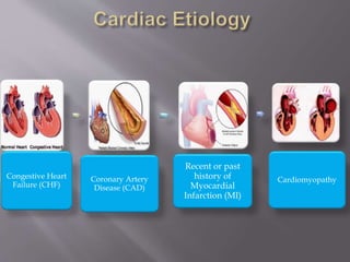Congestive Heart
Failure (CHF)
Coronary Artery
Disease (CAD)
Recent or past
history of
Myocardial
Infarction (MI)
Cardiomyopathy
 