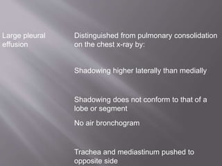 Large pleural
effusion
Distinguished from pulmonary consolidation
on the chest x-ray by:
Shadowing higher laterally than medially
Shadowing does not conform to that of a
lobe or segment
No air bronchogram
Trachea and mediastinum pushed to
opposite side
 