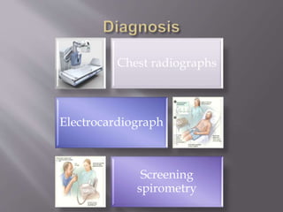 Chest radiographs
Electrocardiograph
Screening
spirometry
 