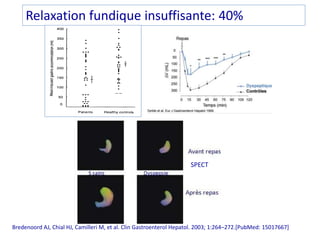 Relaxation fundique insuffisante: 40%
SPECT
Bredenoord AJ, Chial HJ, Camilleri M, et al. Clin Gastroenterol Hepatol. 2003;...
